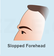 forehead 04